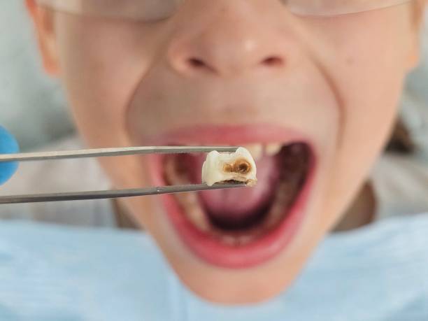 Best Emergency Dentist for Knocked-Out Tooth in Monrovia, MD